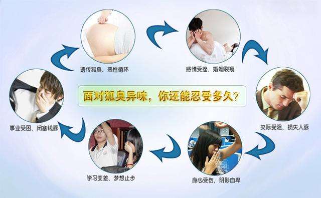 大连腋臭医院 治腋臭挂什么科