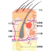 大连翁牛特旗腋臭的病因是什么