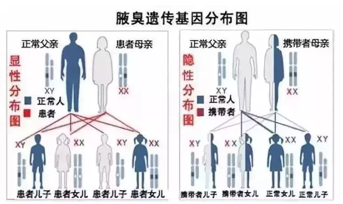 大连林西县腋臭会不会遗传呢