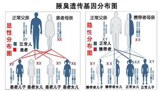 大连巴林左旗母亲有腋臭女儿一定会有吗